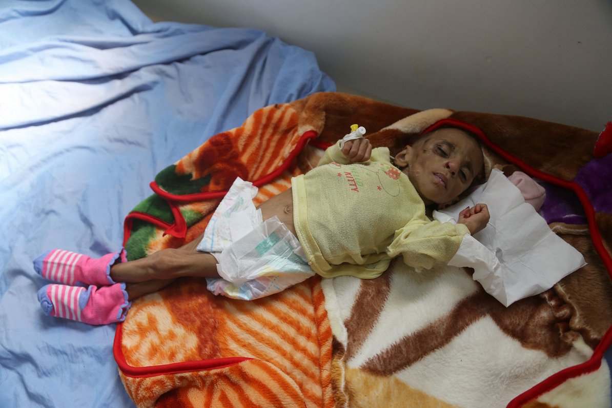 Pieņemts, ka tieši Jemenu šobrīd ir piemeklējusi pasaulē lielākā humānā krīze