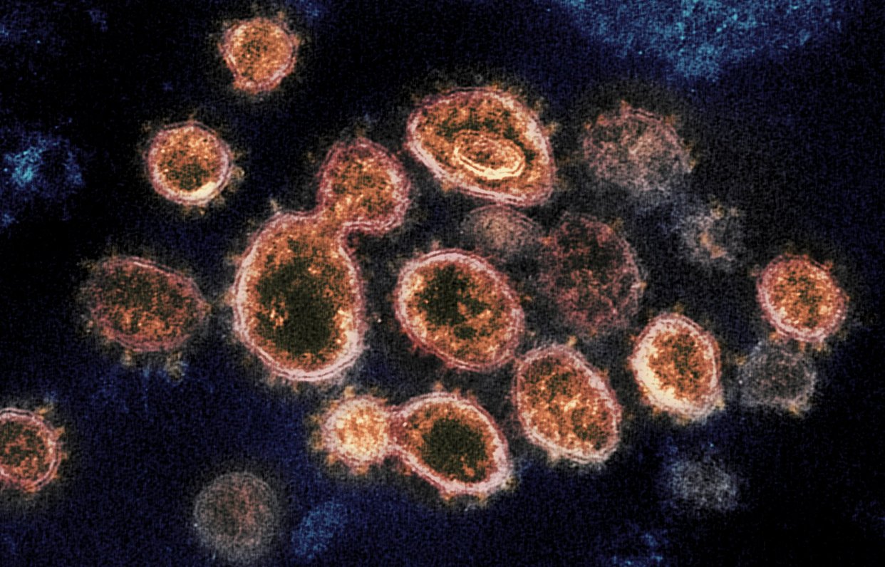 Вид вызывающего Covid-19 вируса под микроскопом