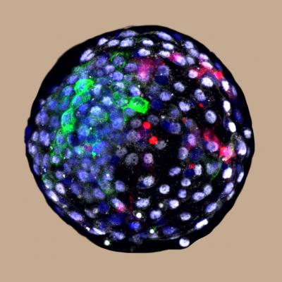 Attēlā redzama himeras cilvēka-pērtiķa blastocista jeb šūnu sakopojums.