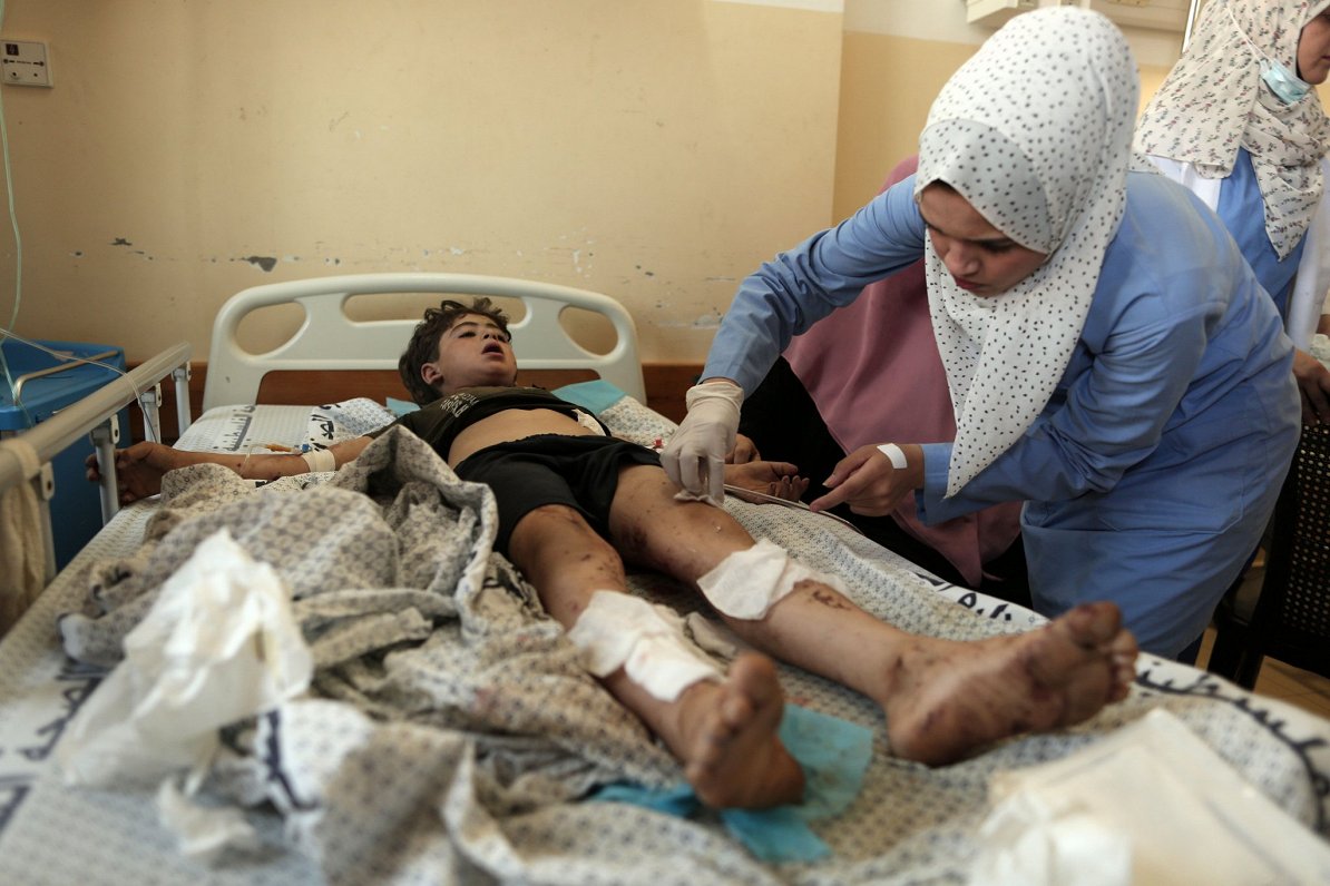 Mediķi sniedz palīdzību palestīniešu zēnam, kurš cietis Izraēlas uzbrukumā