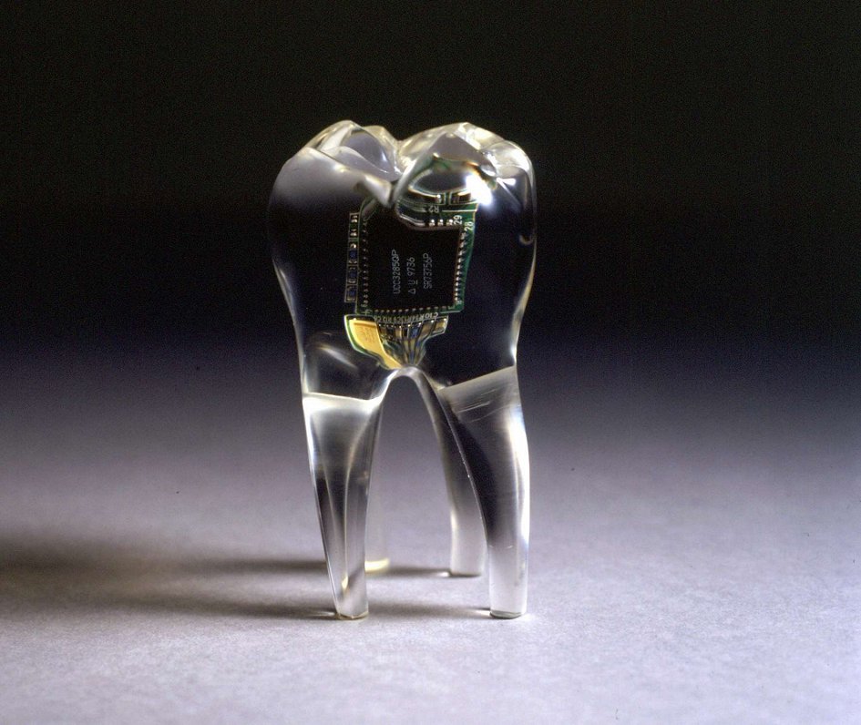 Audio Tooth Implant, Auger &amp; Loizeau, 2002