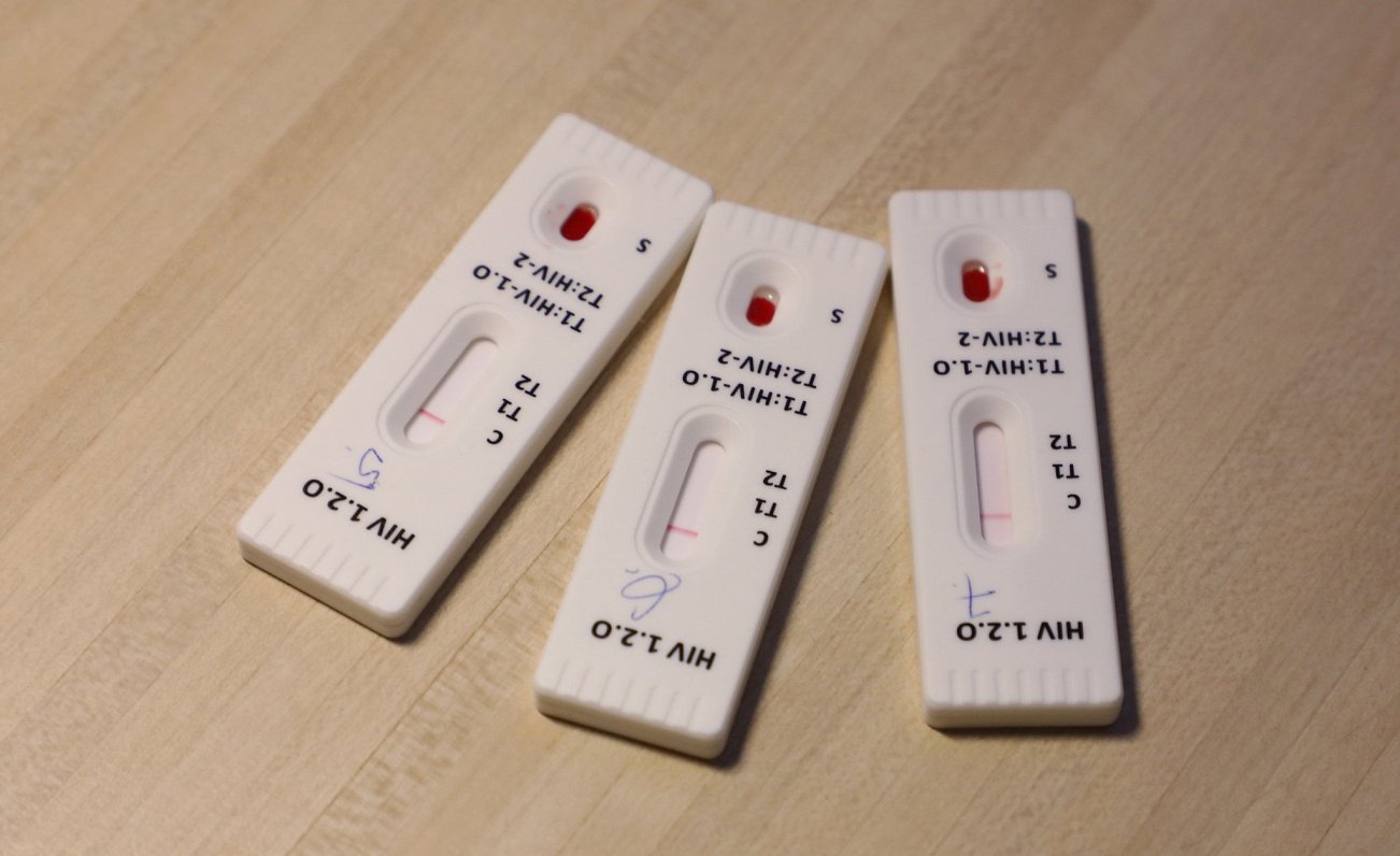 Экспресс-тест на ВИЧ. Иллюстративное фото