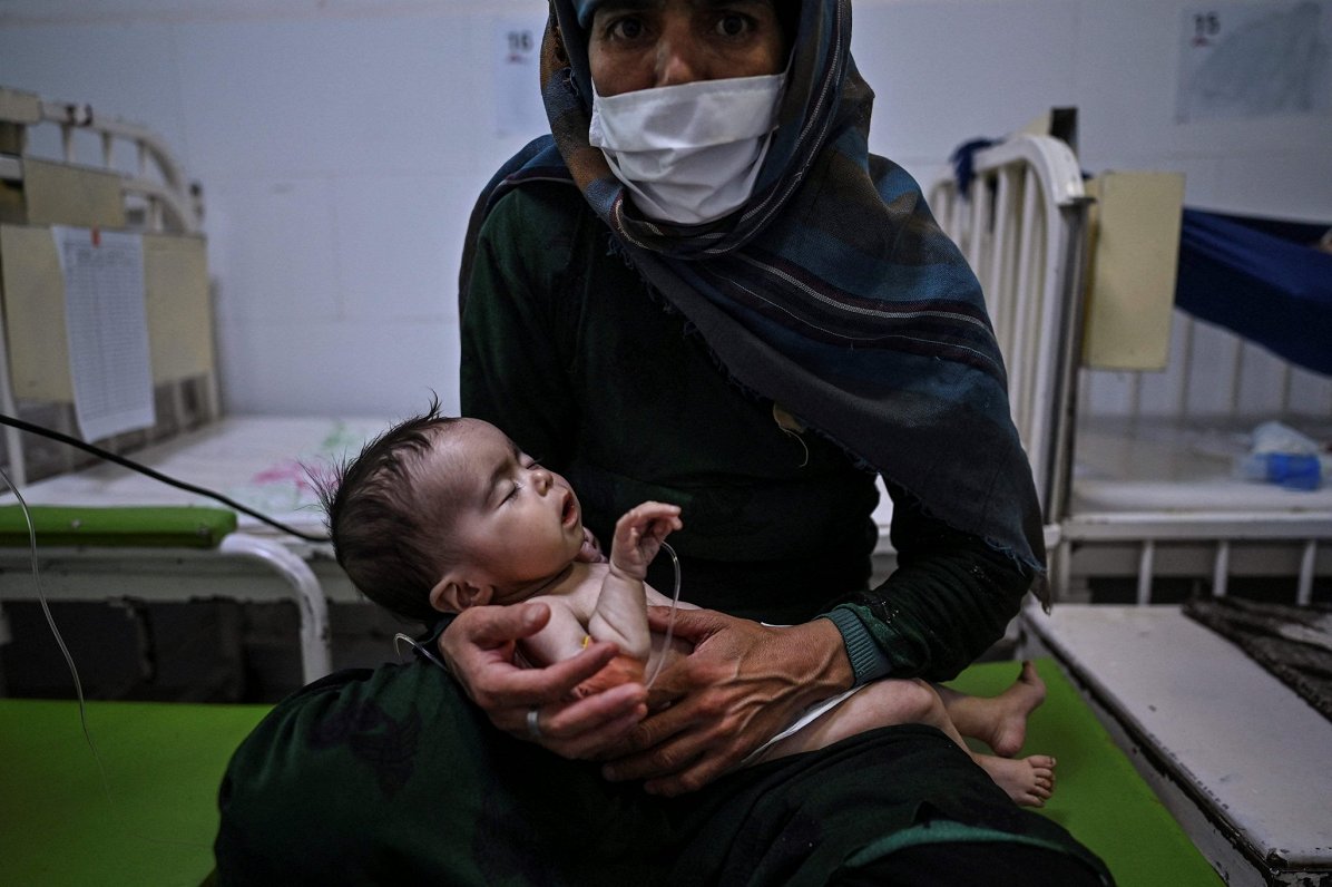 Afganistānā trīs miljoni bērnu cieš no pārtikas trūkuma