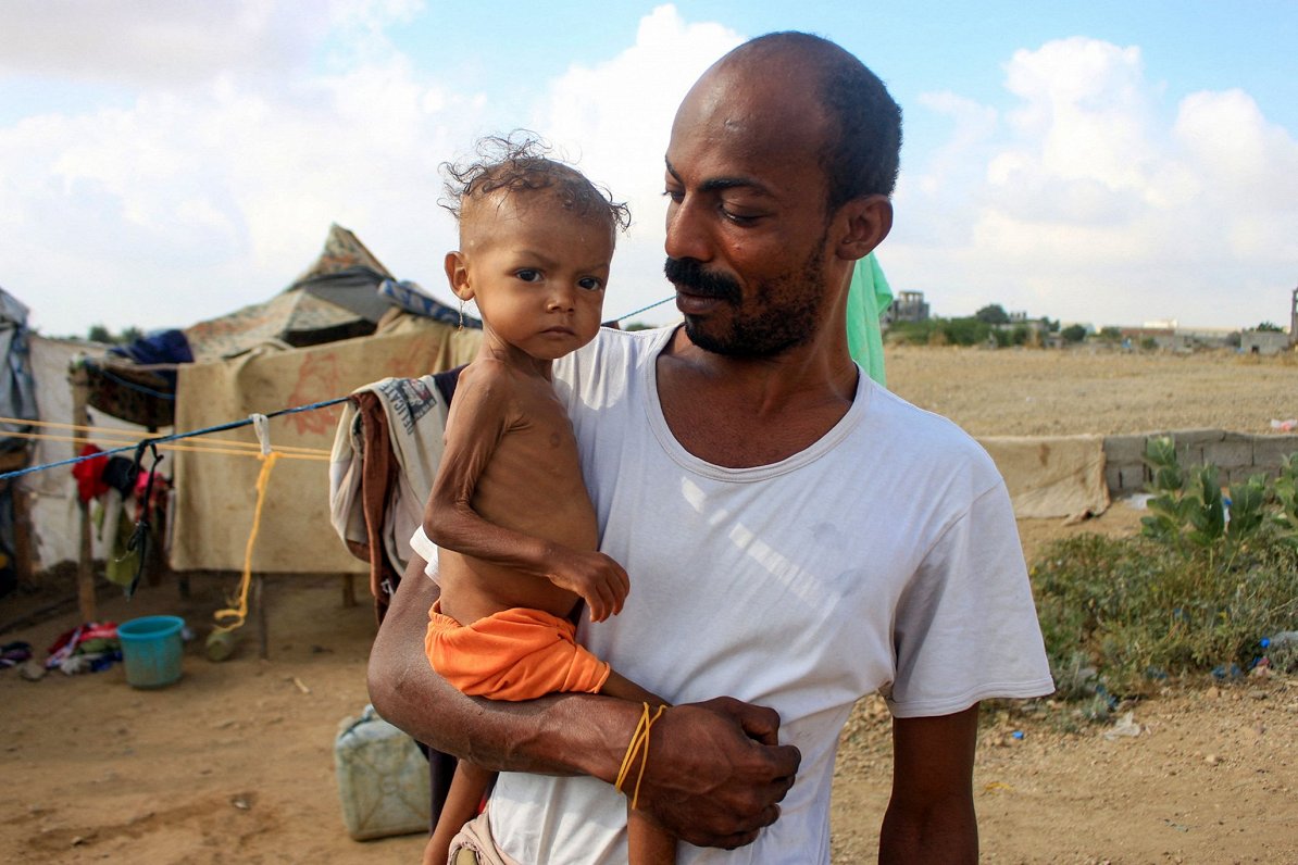 Jemenas bēgļu nometnē tēvs ar izbadējušos bērnu