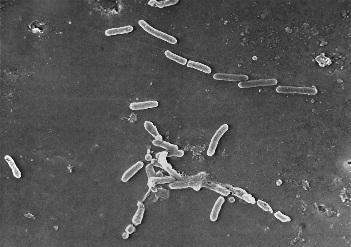 Baktēriju attēls, kas iegūts ar mikroskopu