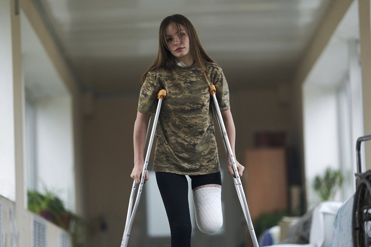 Солдат, потерявшая ногу в бою близ Херсона. Украина, Одесса, 27.02.2023.