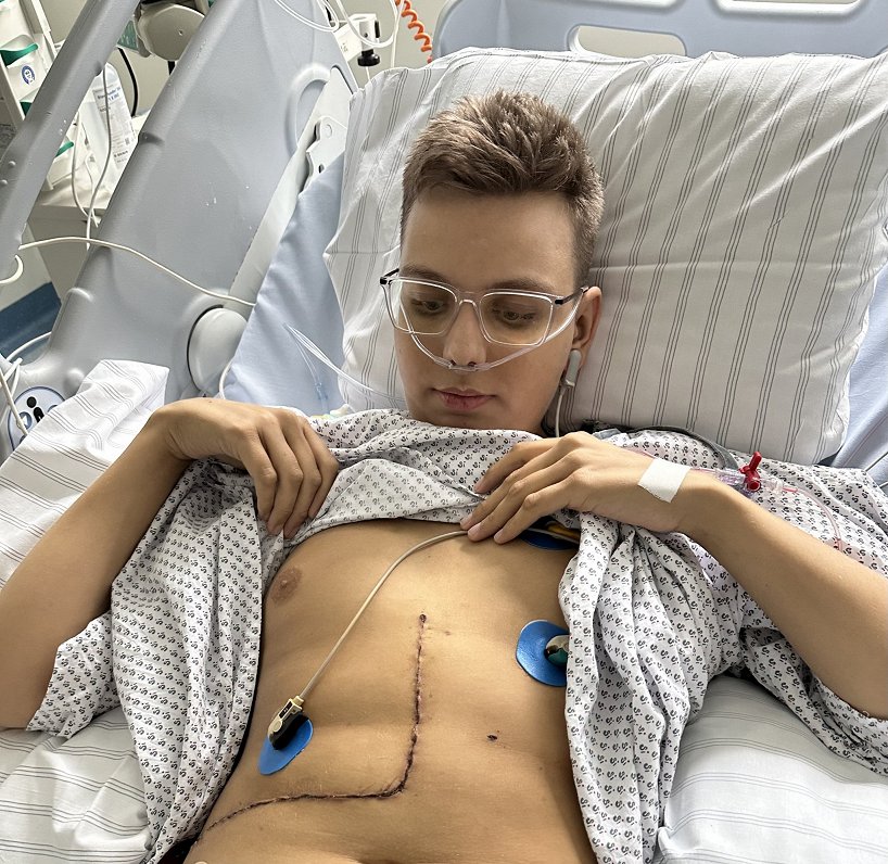 Aleks slimnīcā pēc aknas transplantācijas.