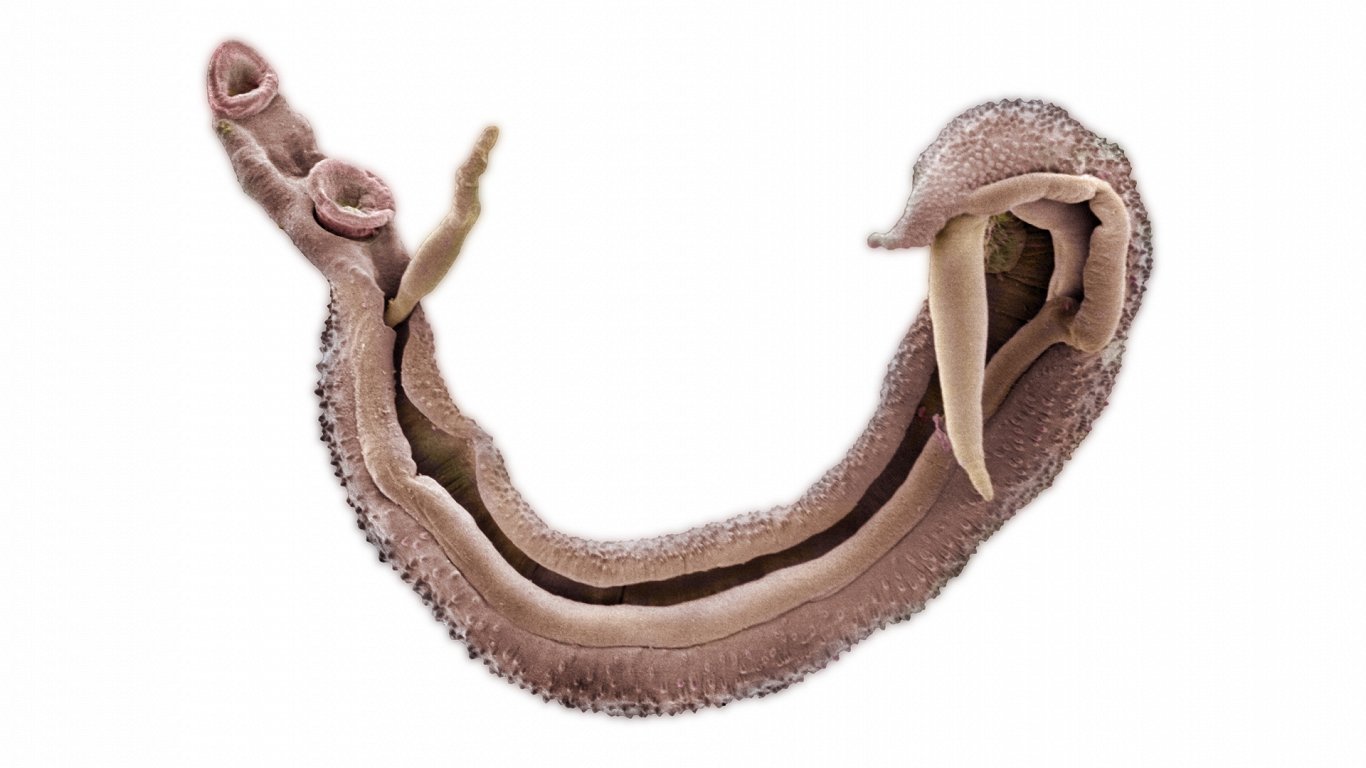 Один из видов червя-шистосомы (Schistosoma Nasale) под электронным микроскопом.